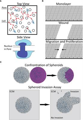 MACC1-induced migration in tumors: Current state and perspective